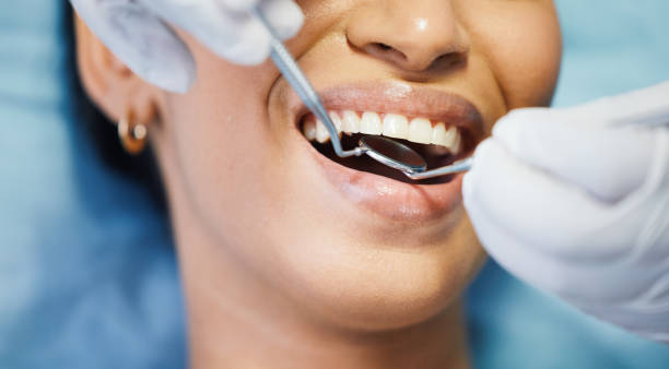 Best Broken Tooth Emergency  in Columbus, WI