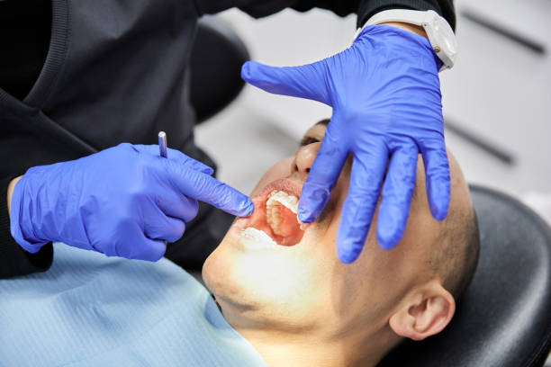 Best Teeth Whitening  in Columbus, WI